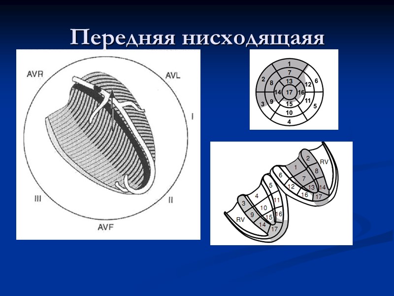 Передняя нисходящаяя